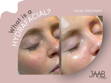 What Is a HydraFacial?